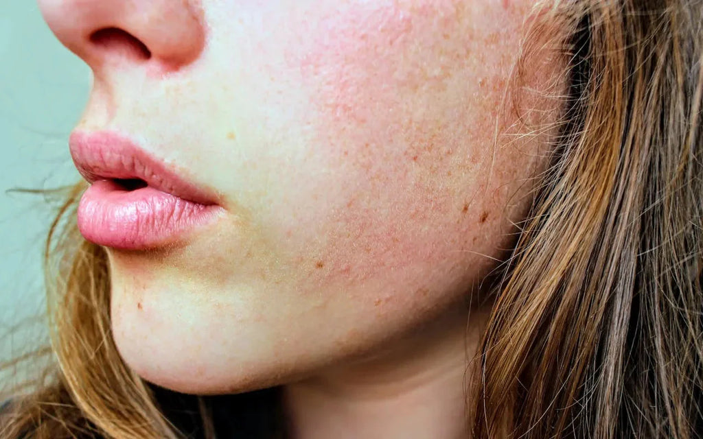 Top 15 Red Light Therapy Benefits for Skin Health