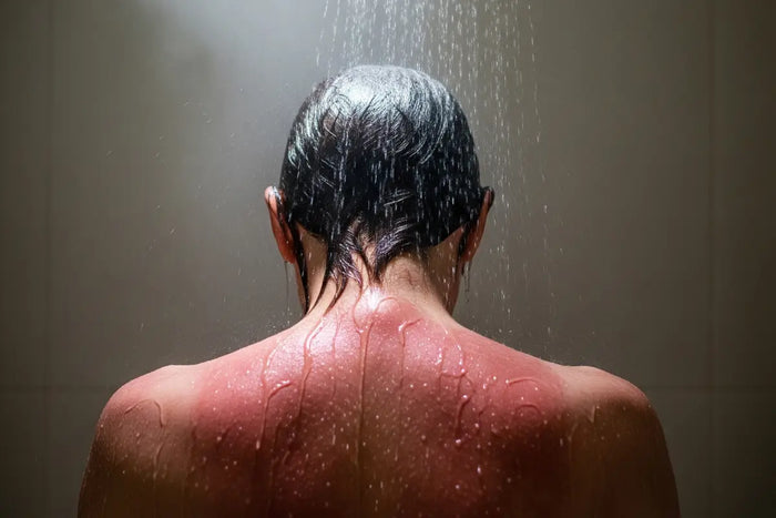 Is A Cold Shower Good For Sunburn?